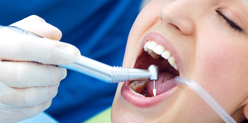 Emergency Dental​ in chicopee