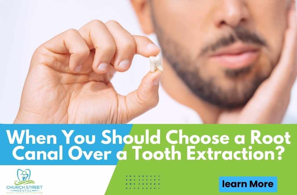 When You Should Choose a Root Canal Over a Tooth Extraction?