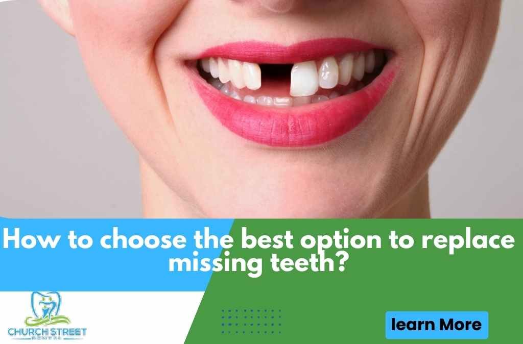 How to Choose the Best Option to Replace Missing Teeth?